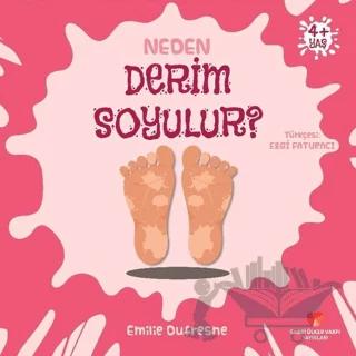 Neden Derim Soyulur?