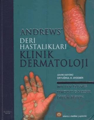 Andrews’ Deri Hastalıkları Klinik Dermatoloji