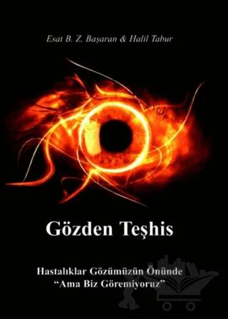 Gözden Teşhis