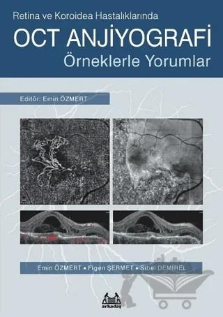 Retina ve Koroidea Hastalıklarında OCT Anjiyografi