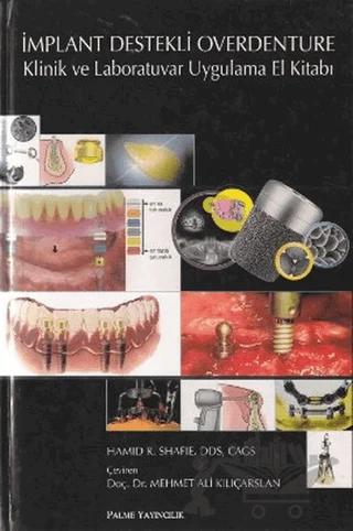 İmplant Destekli Overdenture