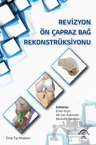Revizyon Ön Çapraz Bağ Rekonstrüksiyonu