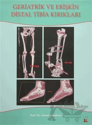 Geriatrik Ve Erişkin Distal Tibia Kırıkları