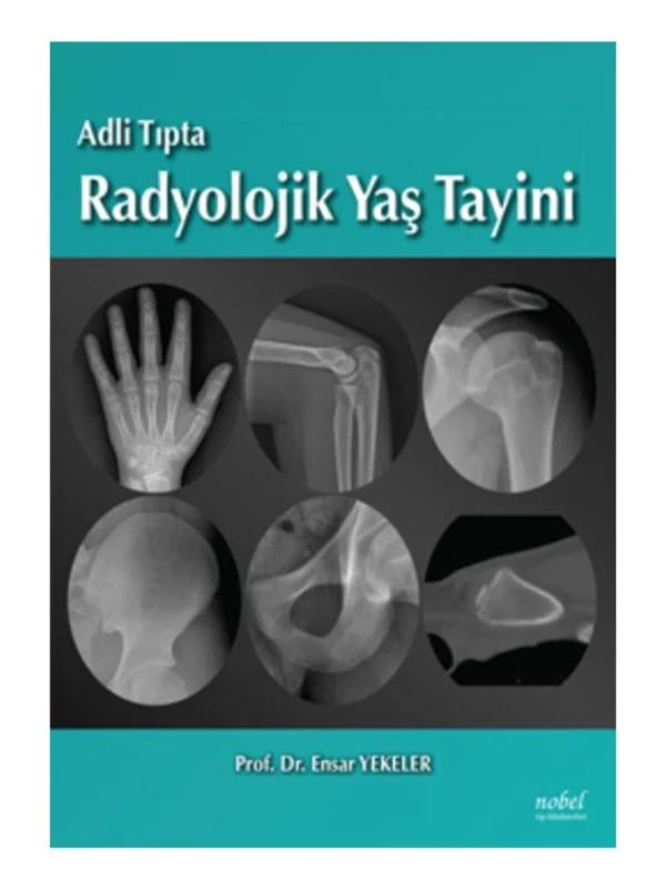 Adli Tıpta Radyolojik Yaş Tayini