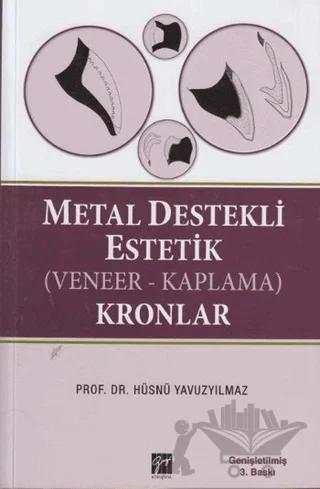 Metal Destekli Estetik (Veneer-Kaplama)Kronlar