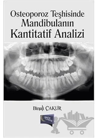 Osteoporoz Teşhisinde Mandibulanın Kantitatif Analizi – Binali Çakur – Gece Kitaplığı kitap kapağı