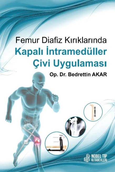 Femur Diafiz Kırıklarında Kapalı İntramedüller Çivi Uygulaması – Nobel Tıp Kitabevleri kitap kapağı