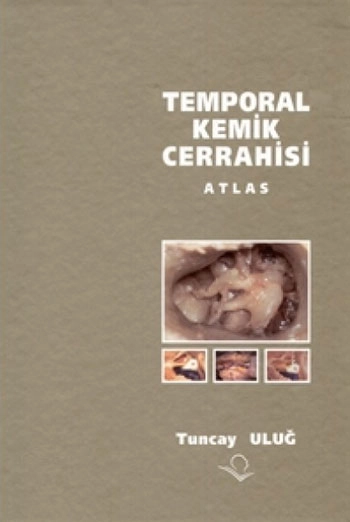 Temporal Kemik Cerrahisi