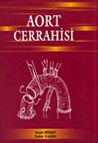 Aort Cerrahisi