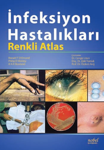 İnfeksiyon Hastalıkları: Renkli Atlas