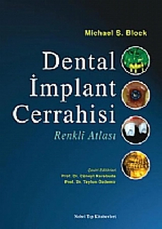 Dental İmplant Cerrahisi Renkli Atlası